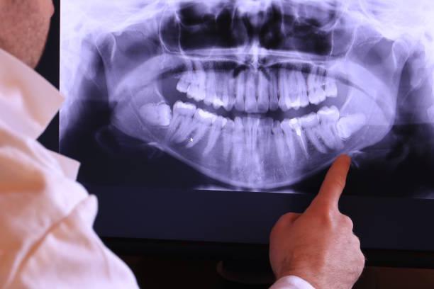 Best Emergency Tooth Extraction in Marvin, NC